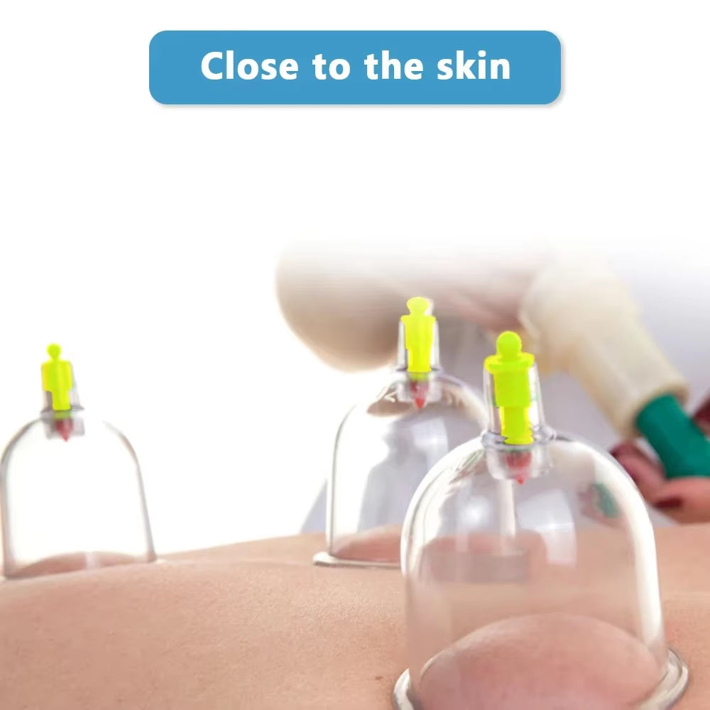 12 Cans Vacuum Cupping Set Chinese Medicine Physiotherapy Fat Burner Slimming Anti-Cellulite Therapy Health Care Body Massager